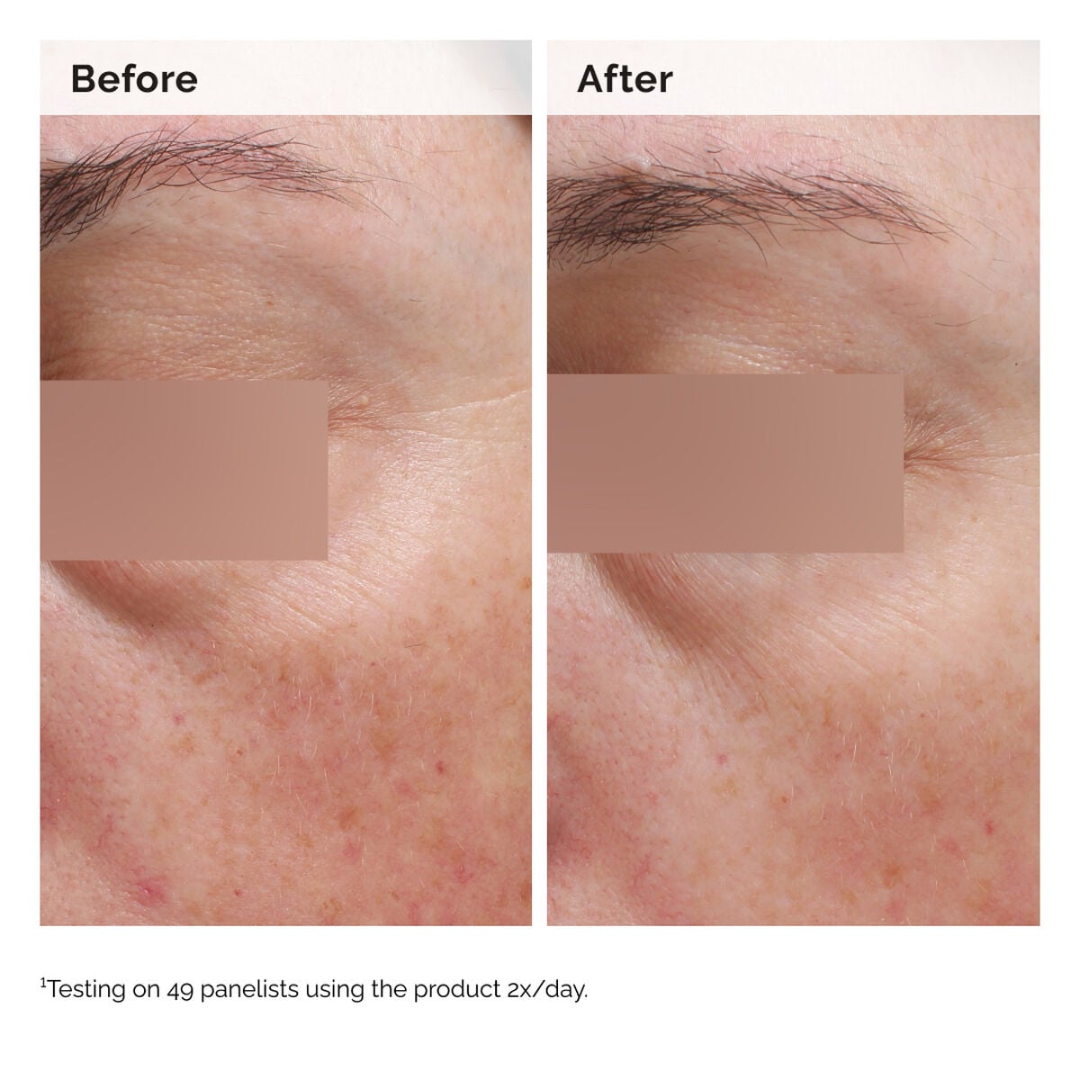 niacinamide-5-face-and-body-emulsion-r5 2024-08-23-ORD-Nia-5pct-Face-Body-B-A-Elasticity-Global-02-1x1.jpg