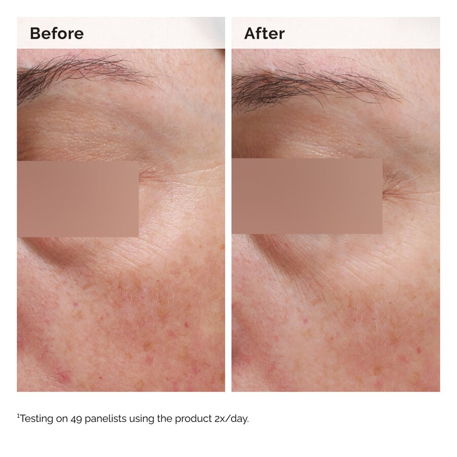 niacinamide-5-face-and-body-emulsion-r5 2024-08-23-ORD-Nia-5pct-Face-Body-B-A-Elasticity-Global-02-1x1.jpg
