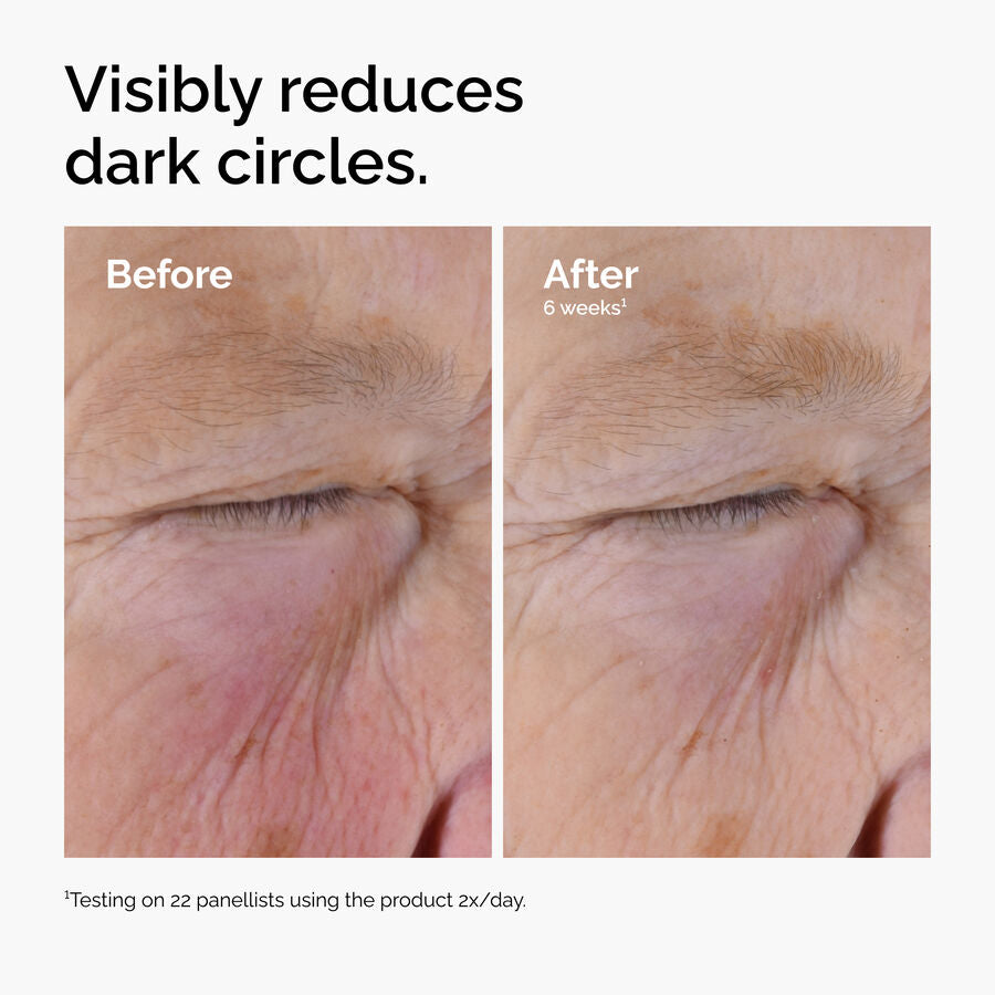 caffeine-solution-5-egcg-eye-serum-s0 ord-caffeine-solution-egcg-dark-circles-before-after.jpg