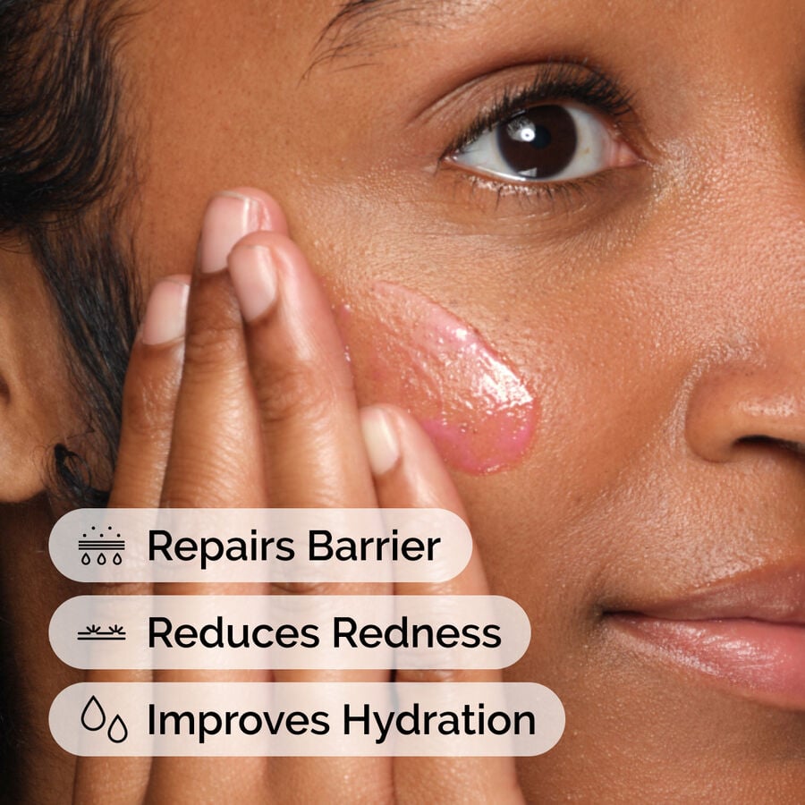 soothing-and-barrier-support-serum-set-u8 ord-soothing-barrier-support-serum-model-application-with-benefits.jpg
