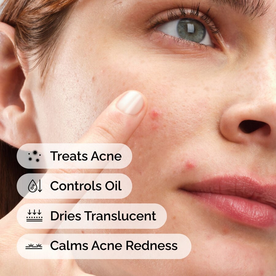 sulfur-10-powder-to-cream-concentrate-u2 ord-sulfur-10pct-powder-to-cream-concentrate-model-application-with-benefits-acne.jpg